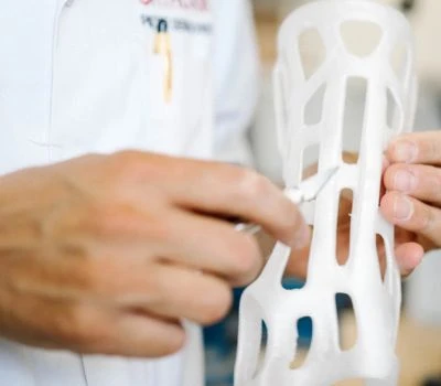 Izvoz STL datoteka formata za 3D štampane ortoze: kako 3D skeniranje stopala pretvara biomehaničk...