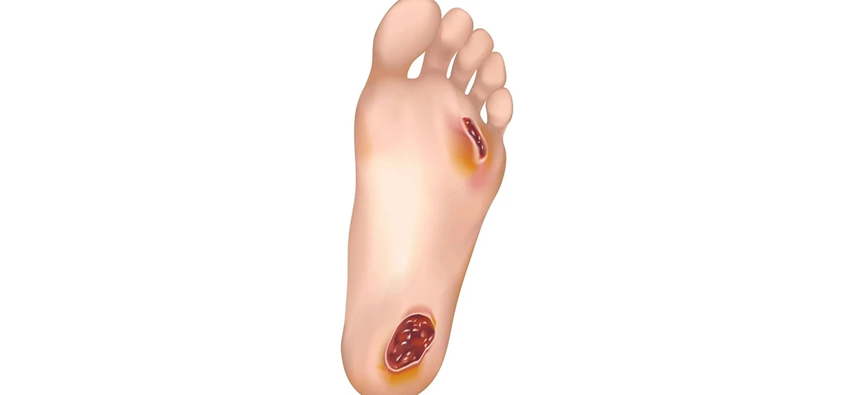 info-1200-560